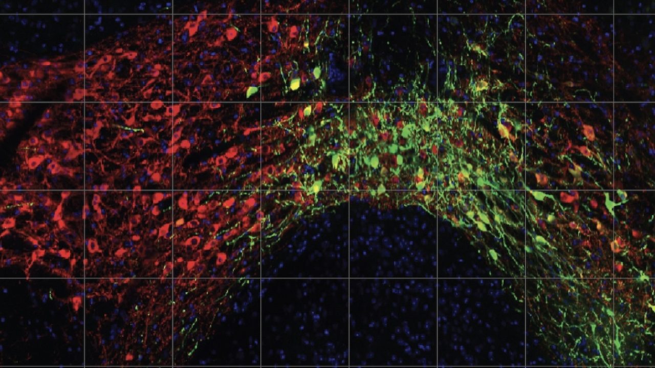 ansorge 2023 molpsych supp